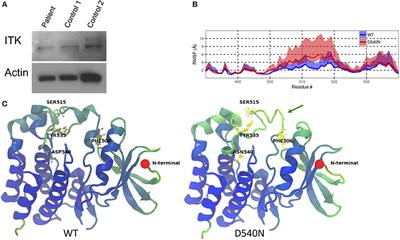 Magnesium Restores Activity to Peripheral Blood Cells in a Patient With Functionally Impaired Interleukin-2-Inducible T Cell Kinase